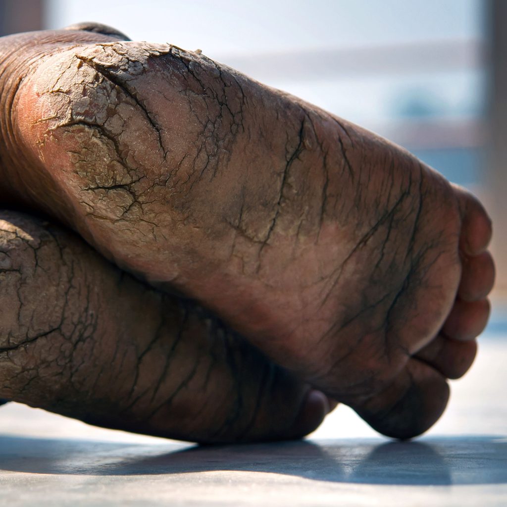 The soles of Sadhu's feet as he reclines on the ground. The heals are cracked and aged.