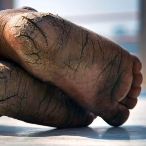 The soles of Sadhu's feet as he reclines on the ground. The heals are cracked and aged.